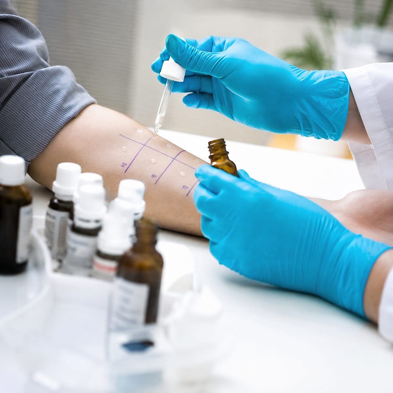 Allergy testing and respiratory assessment