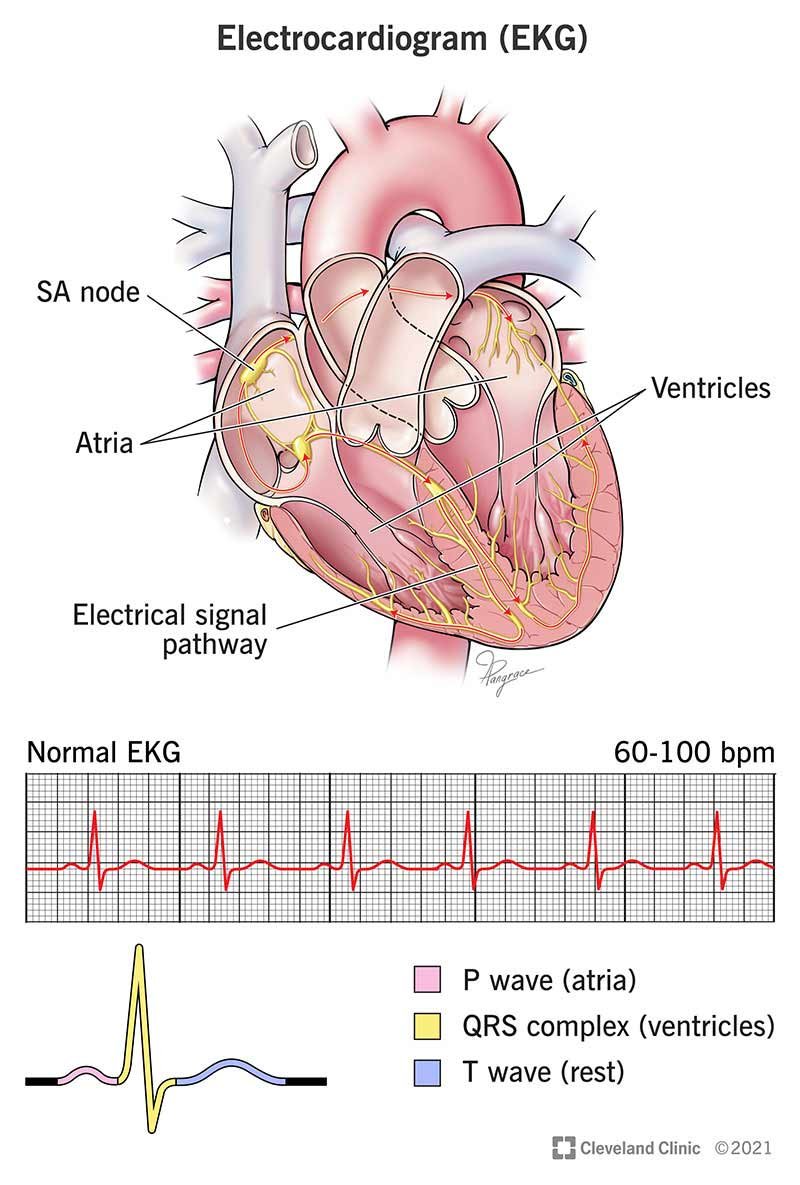 ECG electrocardiogram assessment